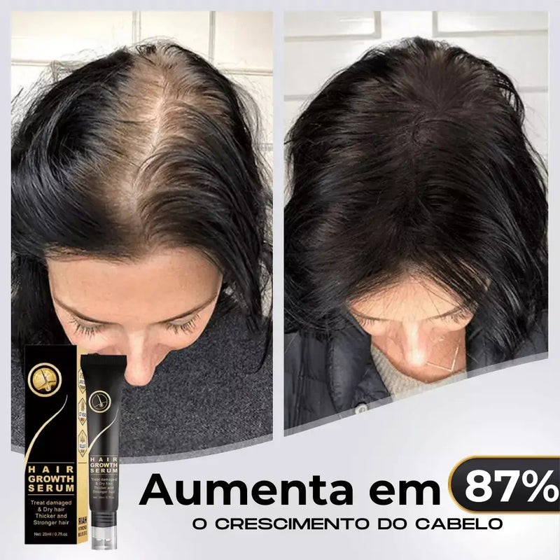 Tônico Capilar Repair Hair® | Crescimento Capilar e Combate à Queda de Cabelo