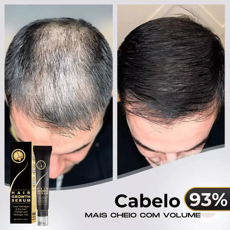 Tônico Capilar Repair Hair® | Crescimento Capilar e Combate à Queda de Cabelo