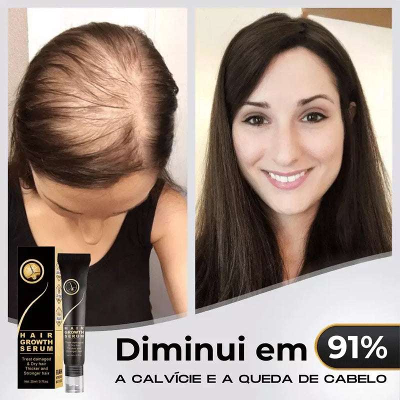 Tônico Capilar Repair Hair® | Crescimento Capilar e Combate à Queda de Cabelo