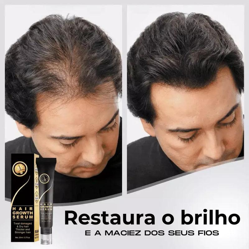 Tônico Capilar Repair Hair® | Crescimento Capilar e Combate à Queda de Cabelo